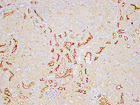 ANGPT2 Polyclonal Antibody