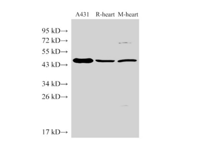 SERPINB2 Polyclonal Antibody